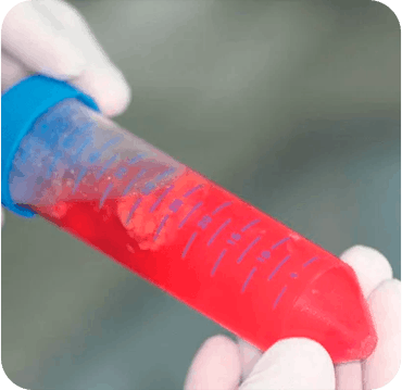 SVF (Fração Vascular Estromal)